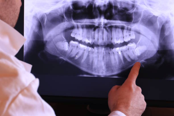 Best Broken Tooth Emergency  in Woodland, WA